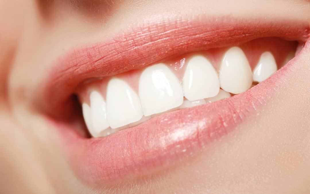How Do I Find the Best Cosmetic Dentist Near Me? 5 Questions to Ask